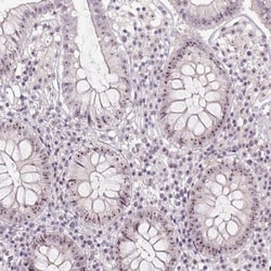 MGC20410 Antibody, Novus Biologicals:Antibodies:Primary Antibodies